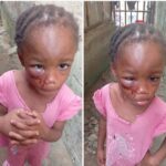Pastor’s Wife Arrested By Police For Assaulting 5-Year-Old Niece In Calabar