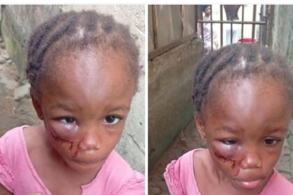 Pastor’s Wife Arrested By Police For Assaulting 5-Year-Old Niece In Calabar