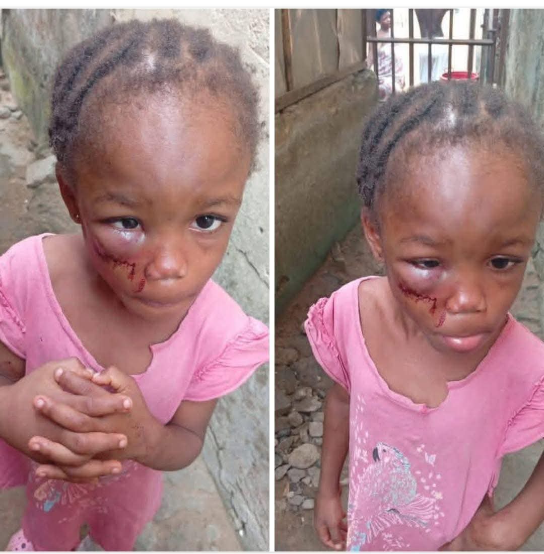 Pastor’s Wife Arrested By Police For Assaulting 5-Year-Old Niece In Calabar