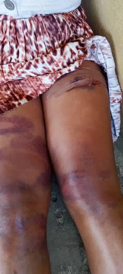 Man Assaults Woman For Rejecting His Advances In Akwa Ibom [Photos]