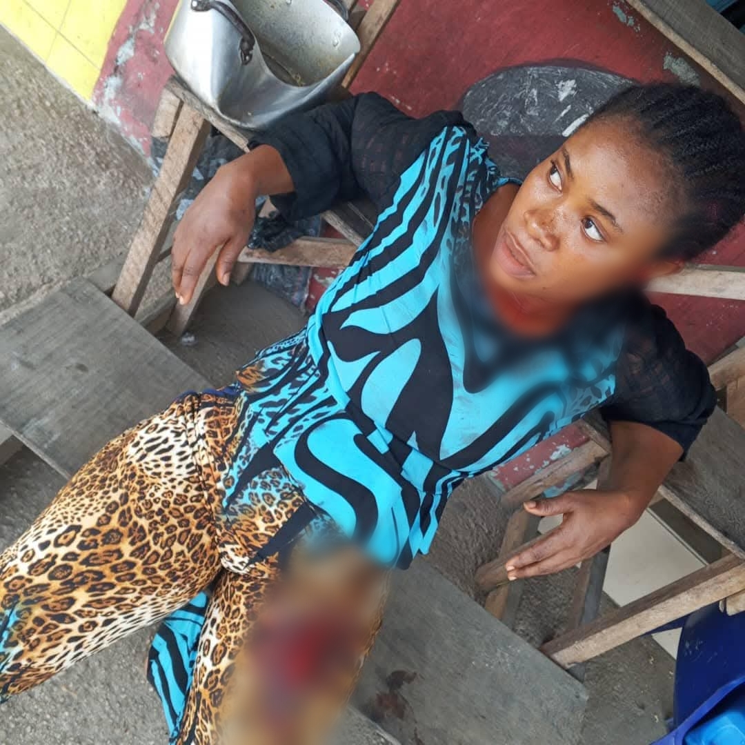 Man Assaults Woman For Rejecting His Advances In Akwa Ibom [Photos]