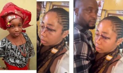 18-Year-Old Girl Brutalized By Husband After Marriage Without Her Father's Consent