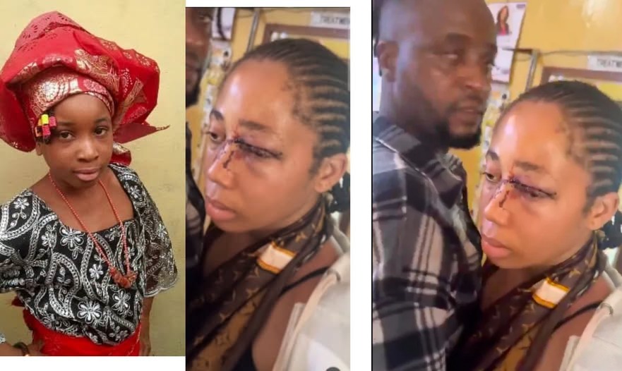 18-Year-Old Girl Brutalized By Husband After Marriage Without Her Father's Consent