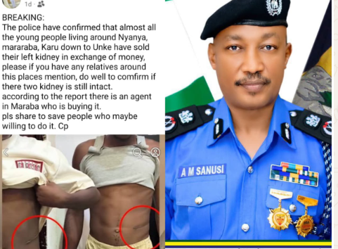 FCT Police Debunks Viral Report Of Kidney Sales In Abuja