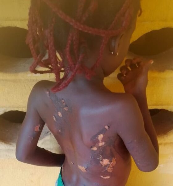 Mother Arrested For Using Hot Knife On 7-Year-Old Daughter In Anambra