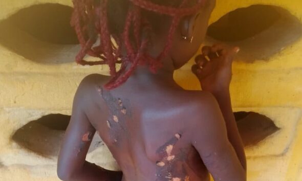 Mother Arrested For Using Hot Knife On 7-Year-Old Daughter In Anambra