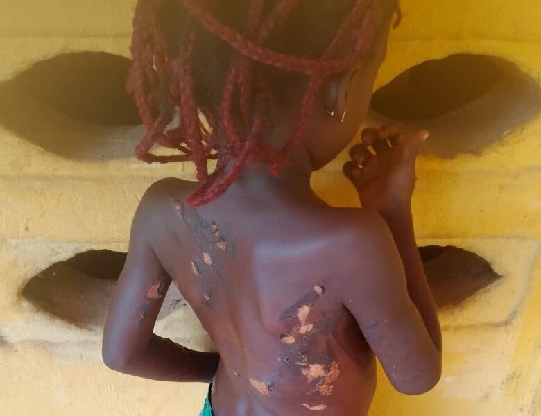 Mother Arrested For Using Hot Knife On 7-Year-Old Daughter In Anambra