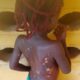 Mother Arrested For Using Hot Knife On 7-Year-Old Daughter In Anambra