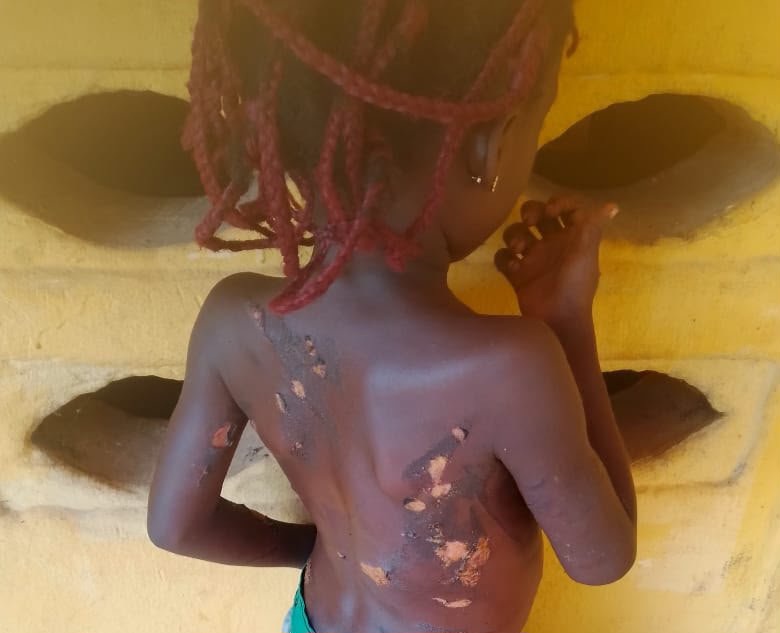 Mother Arrested For Using Hot Knife On 7-Year-Old Daughter In Anambra 5 Mother Arrested For Using Hot Knife On 7-Year-Old Daughter In Anambra