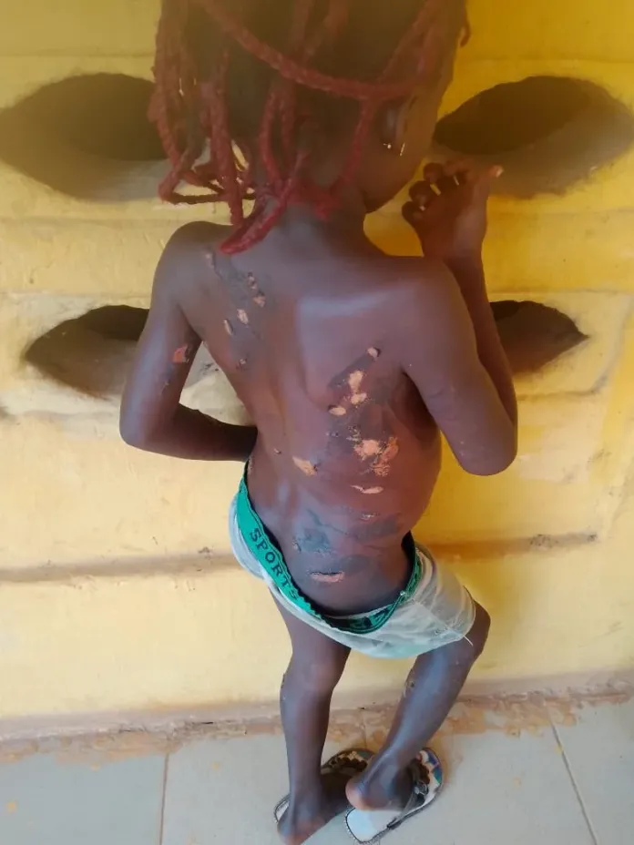 Mother Arrested For Using Hot Knife On 7-Year-Old Daughter In Anambra 6 Mother Arrested For Using Hot Knife On 7-Year-Old Daughter In Anambra