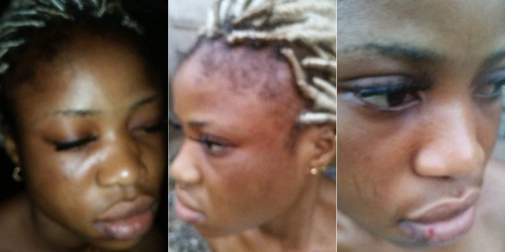 Police Officer Beats Girl Mercilessly For Refusing His Love Proposal In Delta State [Photos] 9